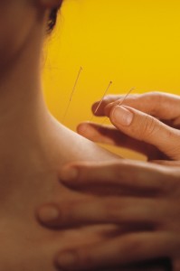 Acupuncture shoulder